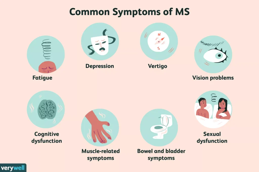 Multiple Sclerosis Newly Diagnosed Females